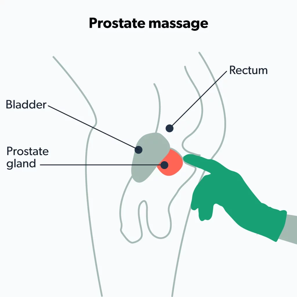 Prostate Massage: What is It, Benefits, How to Use It and How to Choose Right